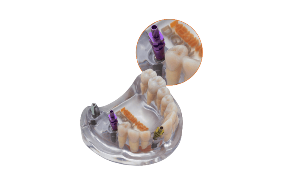 4D-Übungszähne und Lehrmodelle: Zahn 21