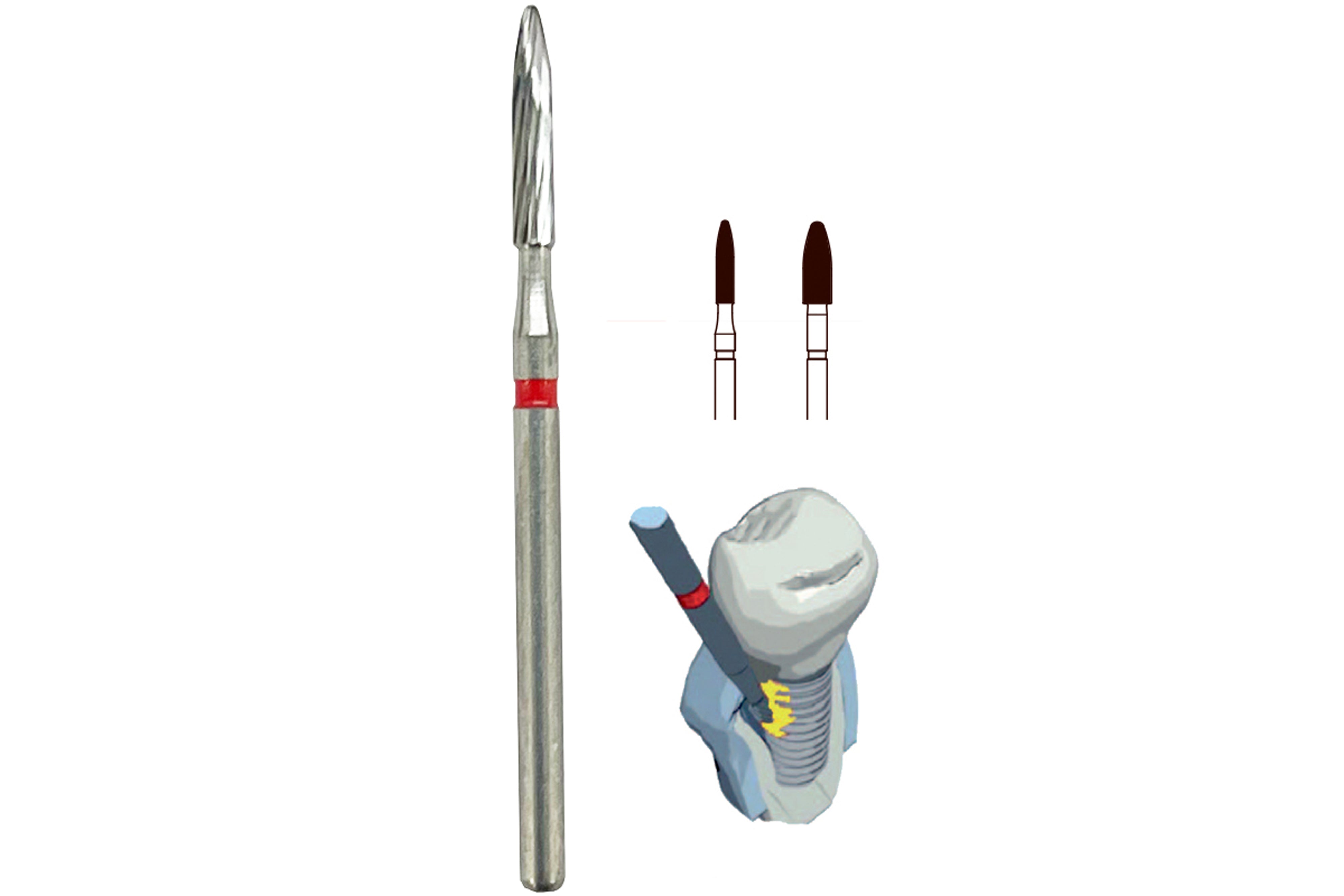 Soft tissue trim and finisher flame-shaped bur, pack of 5 pcs ...